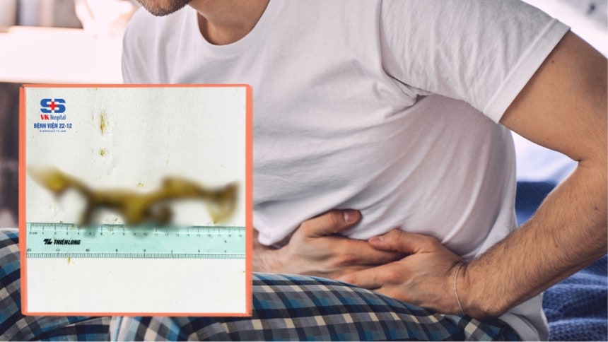 복통, 메스꺼움을 호소하던 50대 남성의 소장에서 20cm 길이 비닐봉지(작은 사진)가 나왔다. 사진=게티이미지뱅크, 병원 SNS