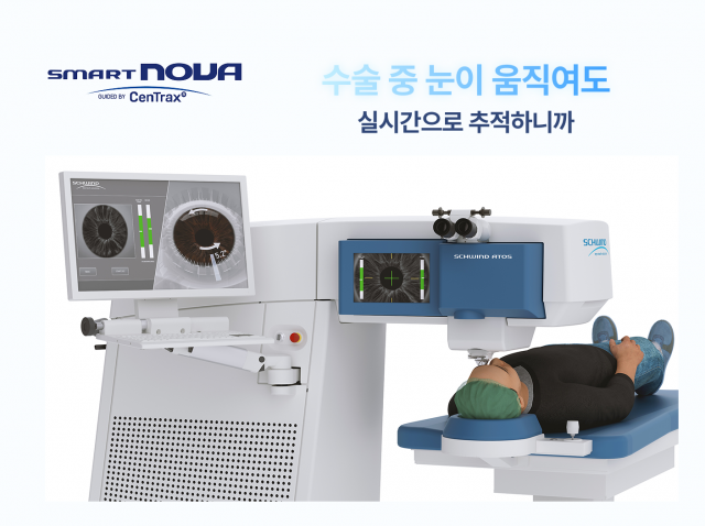 시력교정술 선택지 넓어진다… 스마트 노바, 국내 누적 수술 1만 건 돌파